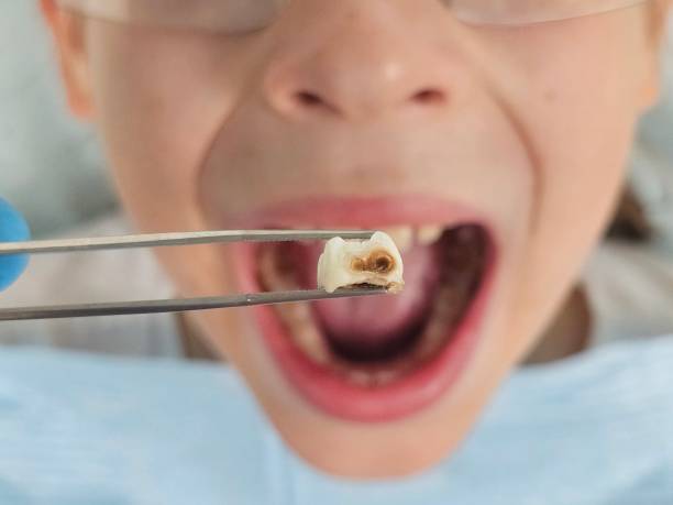 Professional Emergency Dental Service in MN